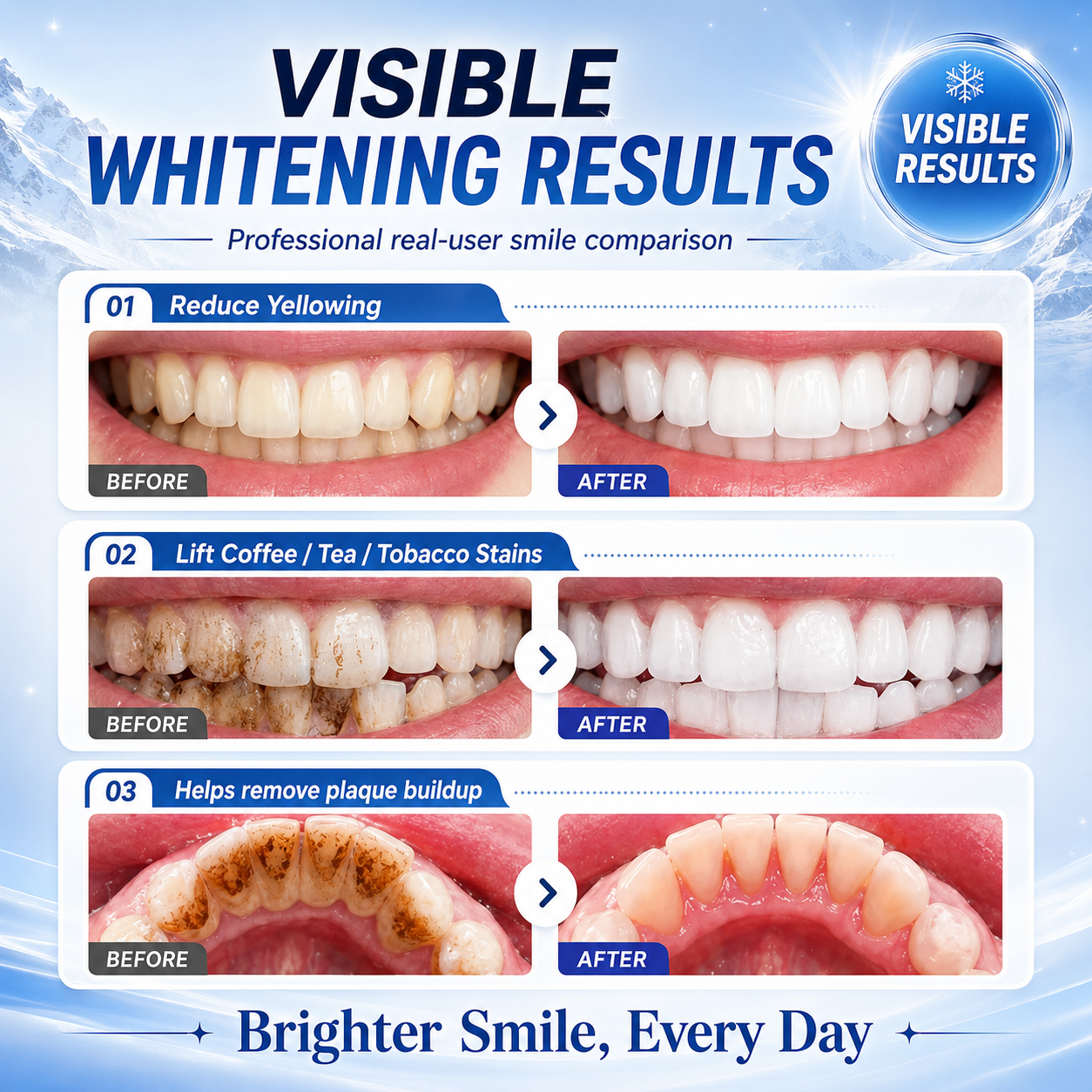 [Professional Grade] Niacinamide Foaming Toothpaste 8X