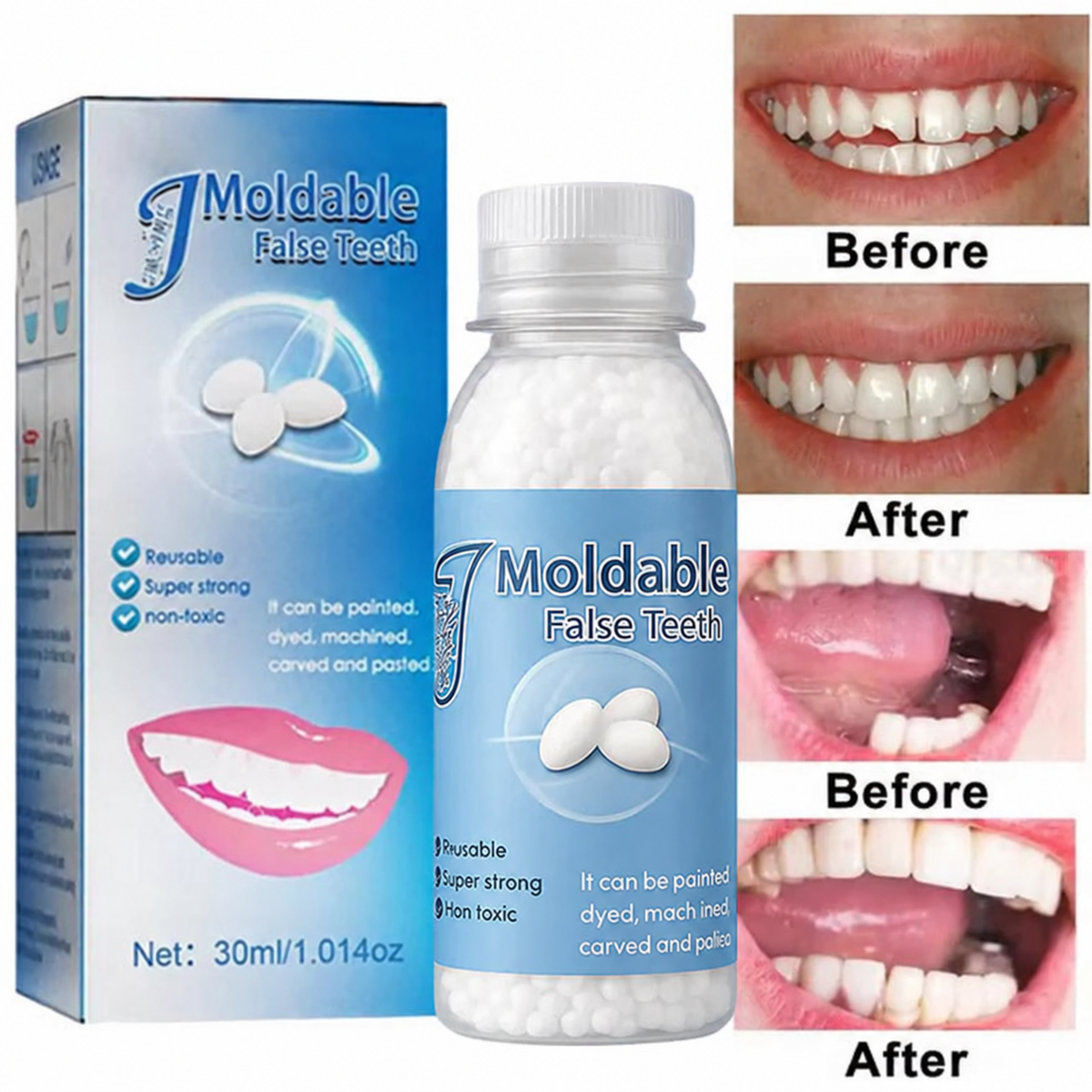 🦷 Dental Filling Gel – Pain-Free, Drill-Free Cavity Solution💖💖
