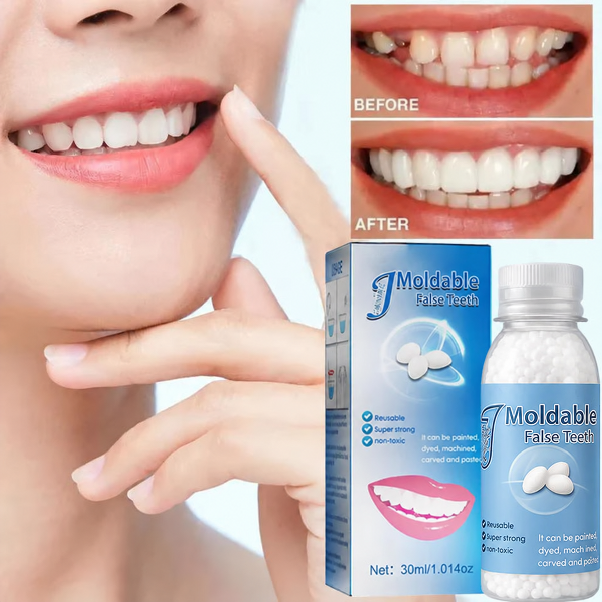 🦷 Dental Filling Gel – Pain-Free, Drill-Free Cavity Solution💖💖