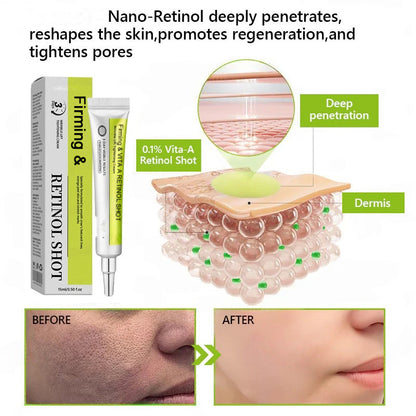 Retinol Shot – Deep Wrinkle Smoothing, Firming Care for Sagging Jowls & Puffy Eyes