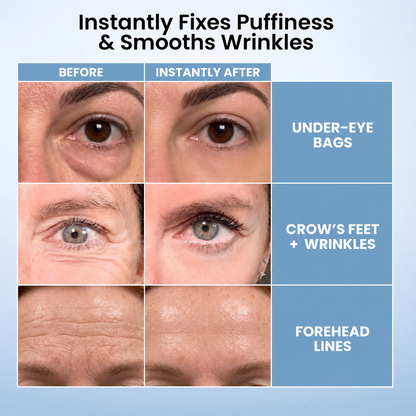 Instant Eye Tightener – Visibly Reduce Under-Eye Bags & Wrinkles in Minutes