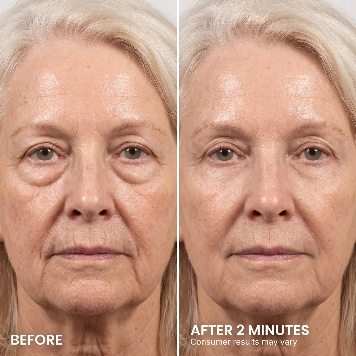 Instant Eye Tightener – Visibly Reduce Under-Eye Bags & Wrinkles in Minutes