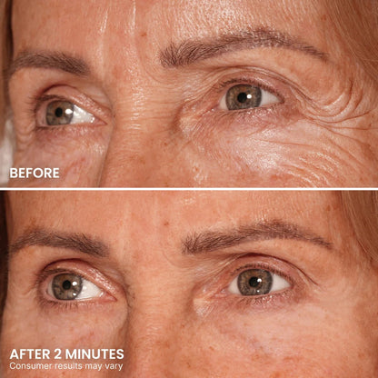 Instant Eye Tightener – Visibly Reduce Under-Eye Bags & Wrinkles in Minutes