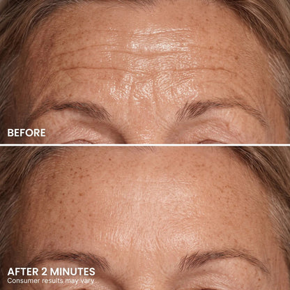 Instant Eye Tightener – Visibly Reduce Under-Eye Bags & Wrinkles in Minutes