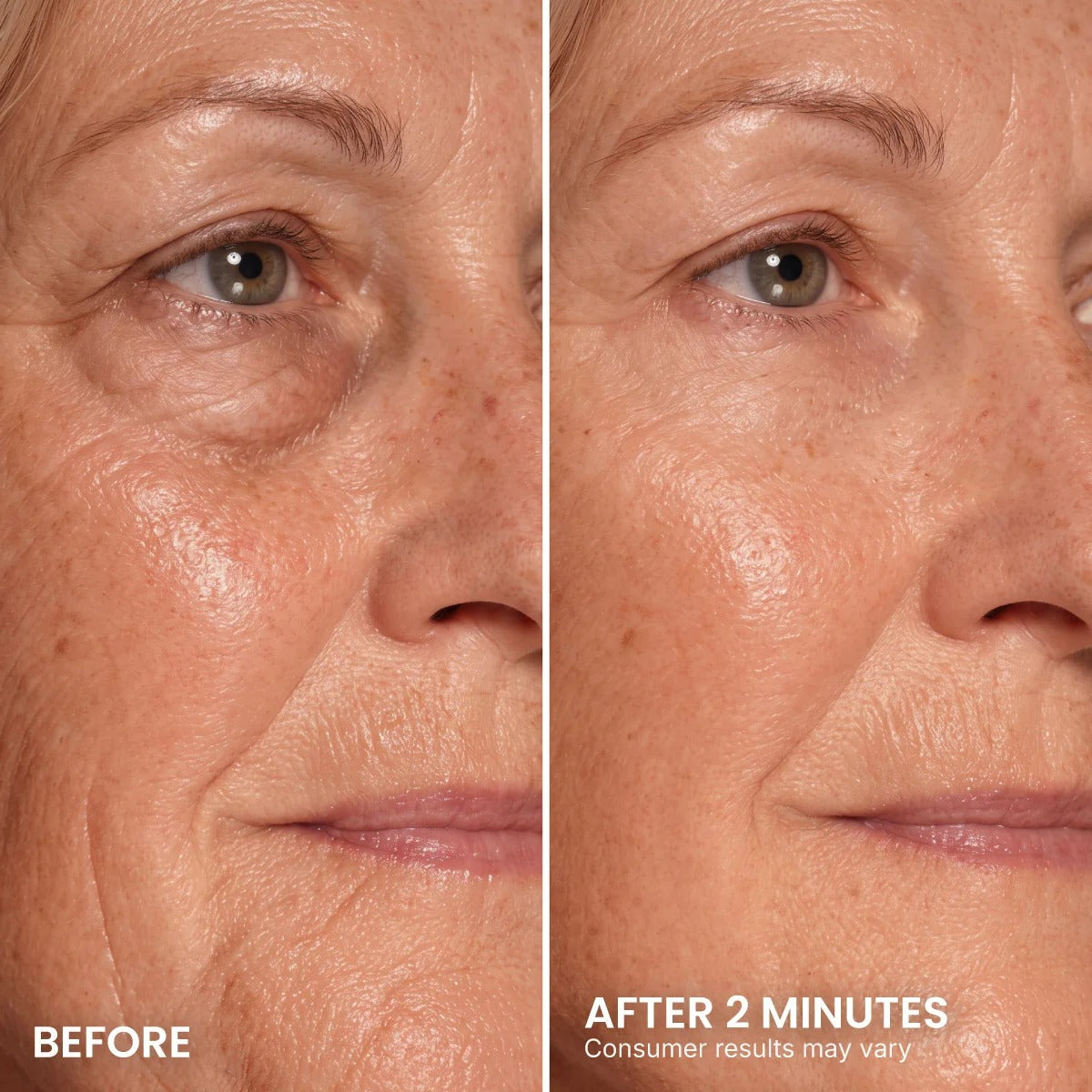 Instant Eye Tightener – Visibly Reduce Under-Eye Bags & Wrinkles in Minutes
