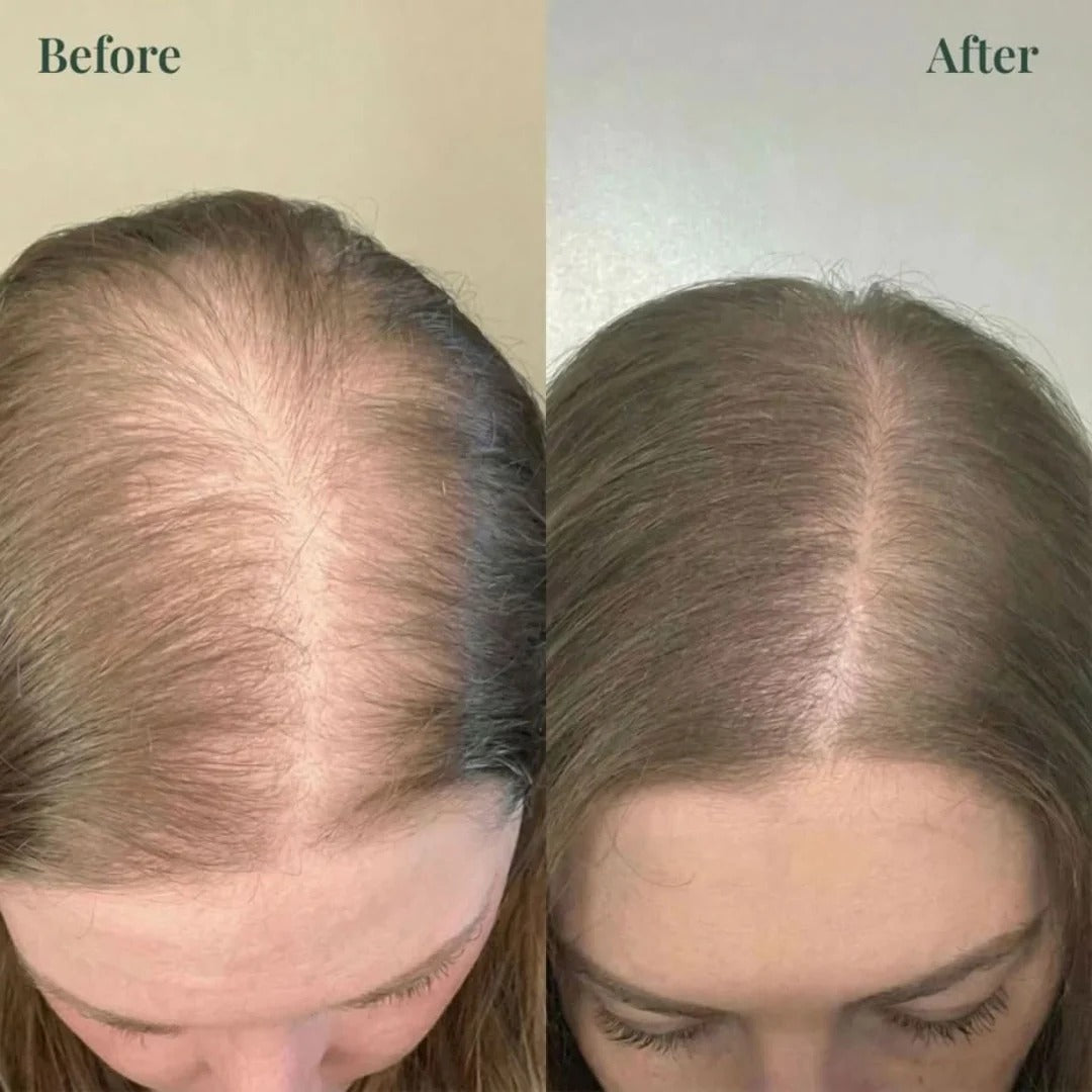 Rosemary Keratin Volumizing Shampoo-🔥Buy 1 Get 1 Free!