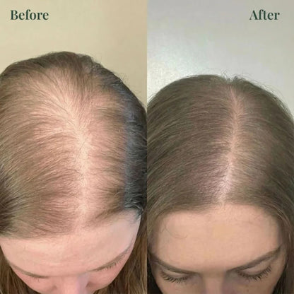 Rosemary Keratin Volumizing Shampoo-🔥Buy 1 Get 1 Free!
